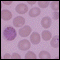Malaria Infected Red Blood Cells